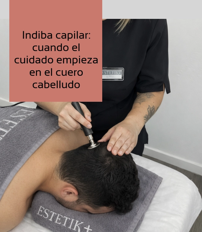 Tratamiento de Indiba capilar en Clínicas Alsale Estetik+ para mejorar la salud del cuero cabelludo y fortalecer el cabello desde el origen.